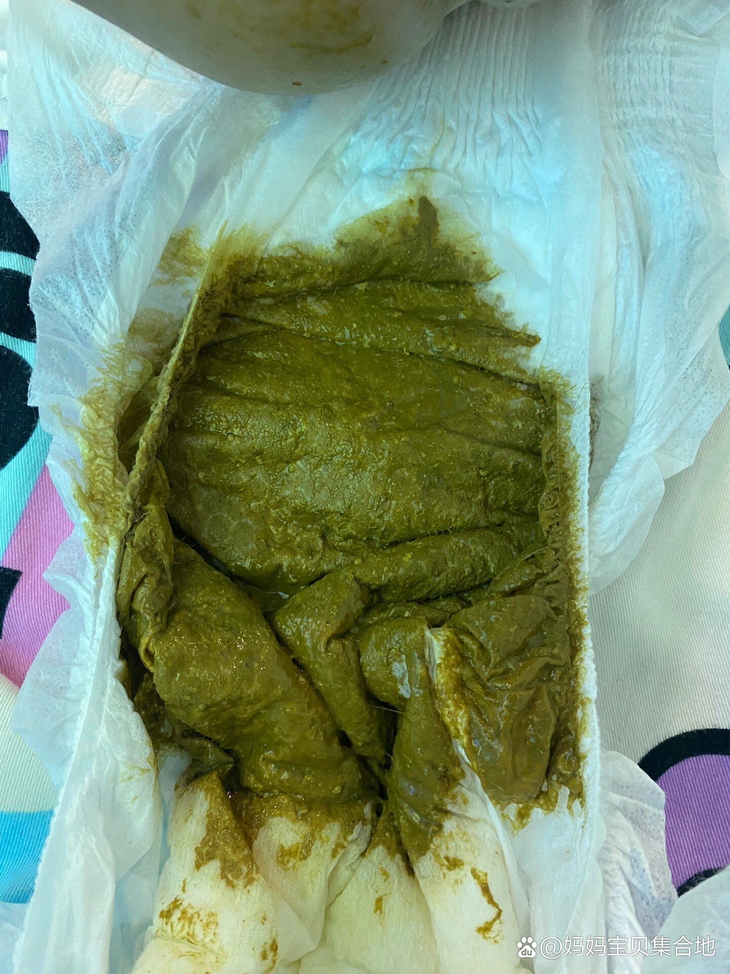 宝宝经常积食