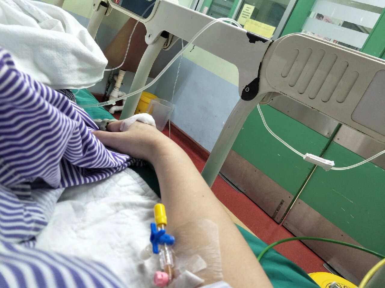 插管的真实图片40岁女人在医院肺部插着管子的真实照片医院冬种治疗