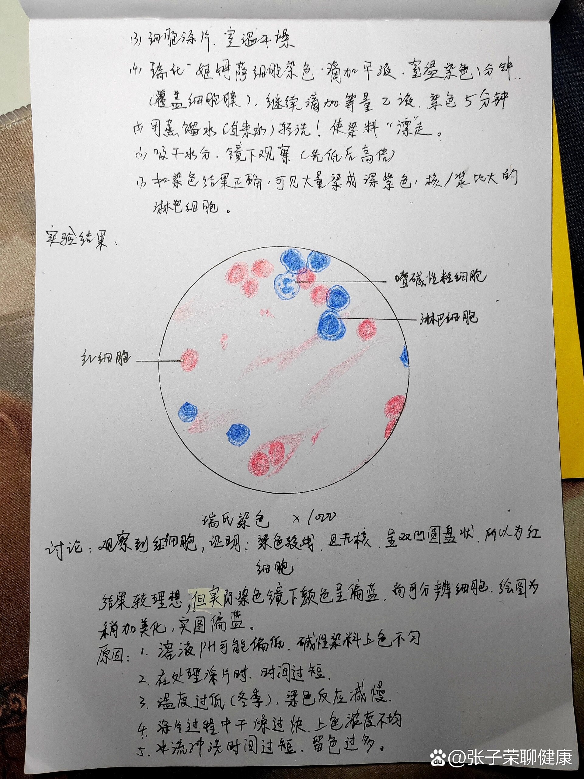 小鼠脾脏手绘图片图片