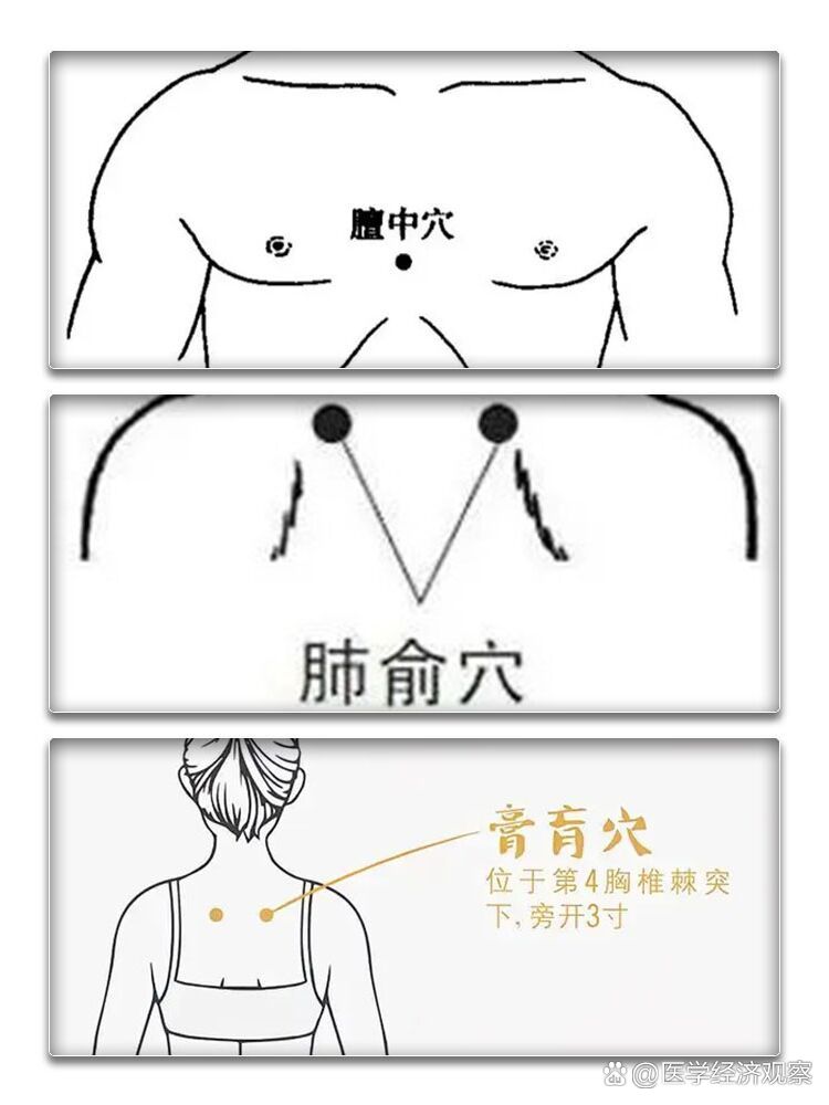 三伏贴这三个贴敷穴位你知道吗