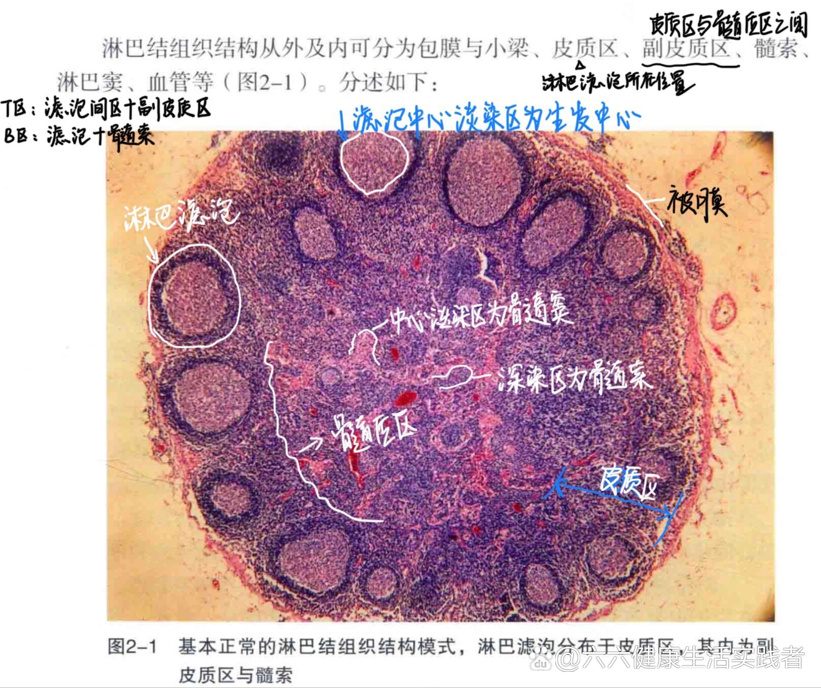 淋巴结皮质图片图片