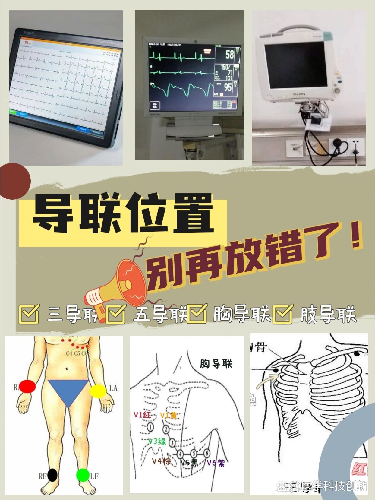 护士笔记6|心电监护仪导联位置记混淆01