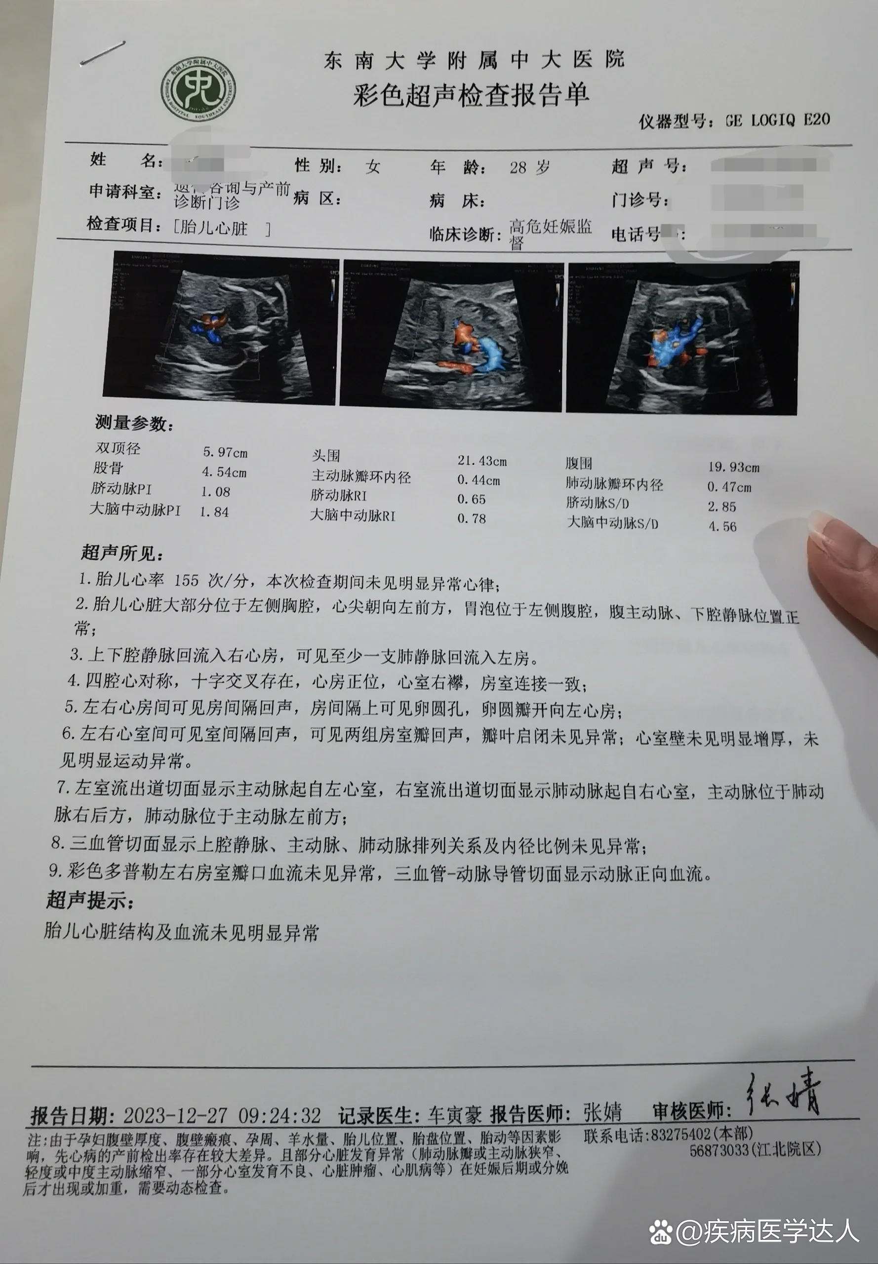 心包积液超声报告图片