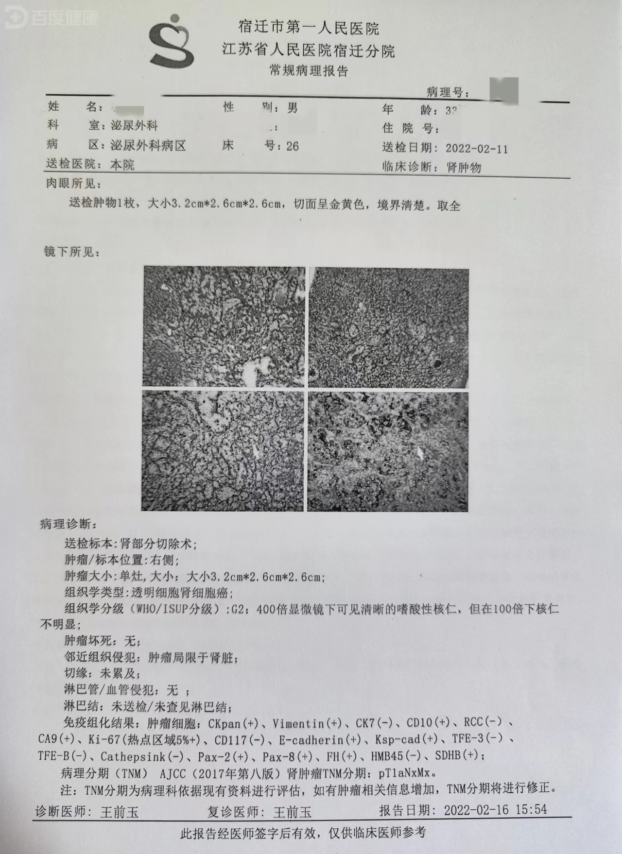 肾癌报告图片