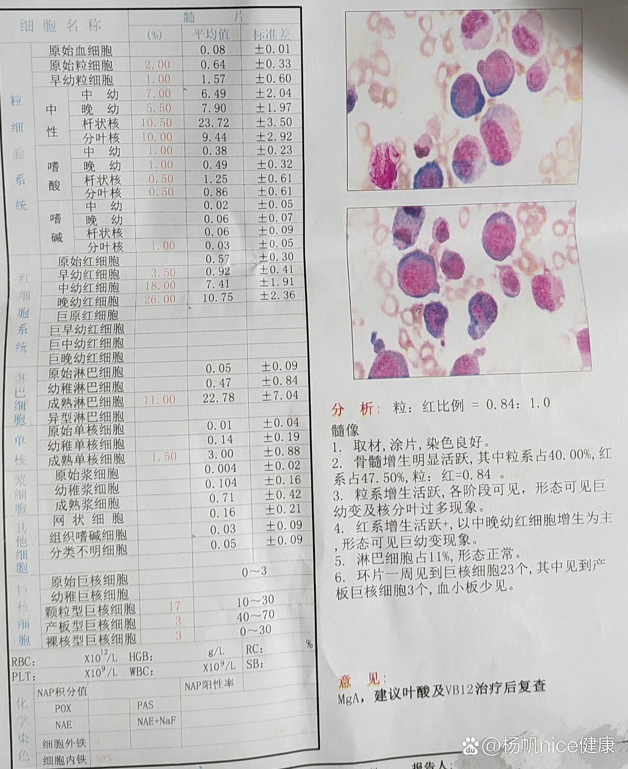 骨穿报告图片