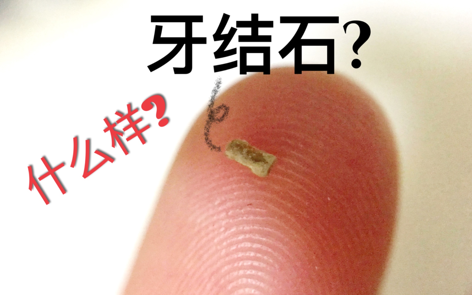 牙缝里的牙结石,怎么有效清除?医生:教你3个方法,轻松除牙垢