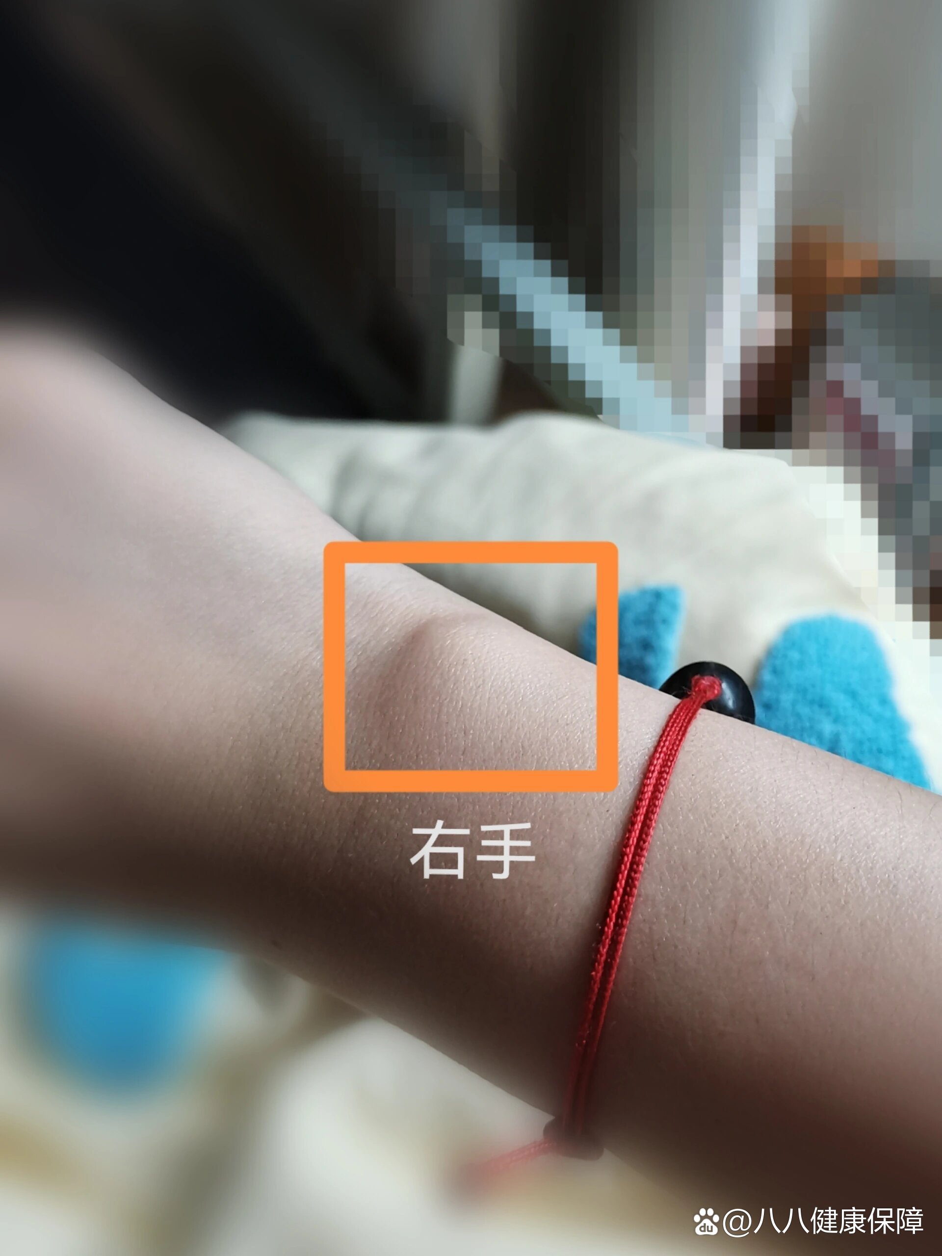 右手手腕骨头凸起较大,小红书问诊