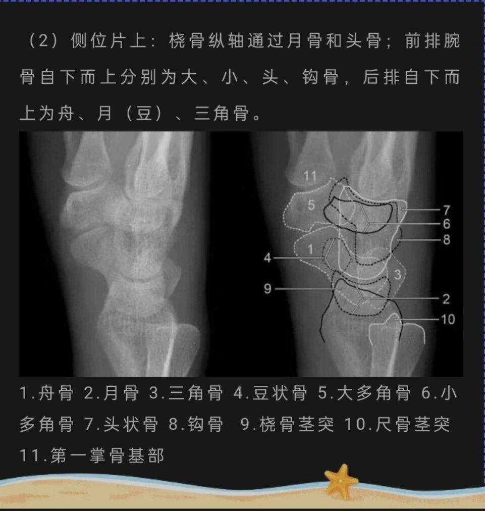 左手腕解剖图图片