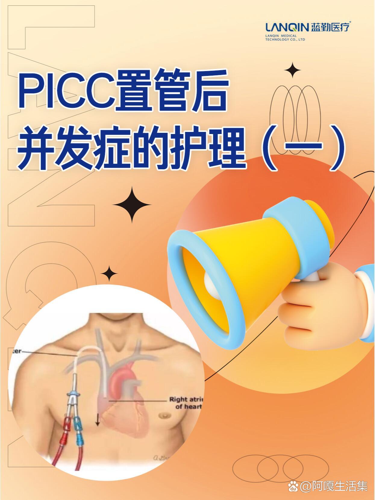 picc置管后并发症的护理(一)