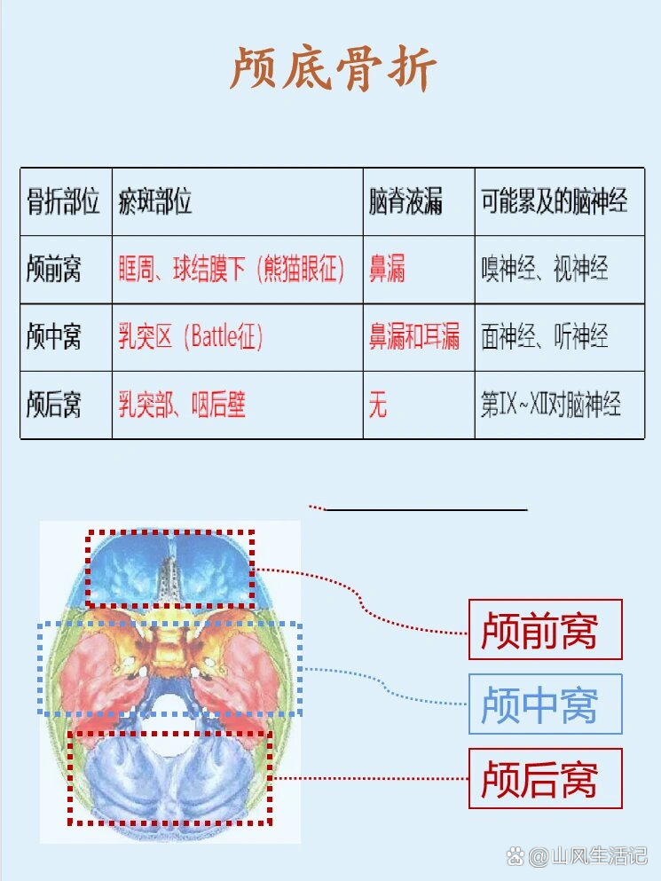 颅骨骨折ppt图片