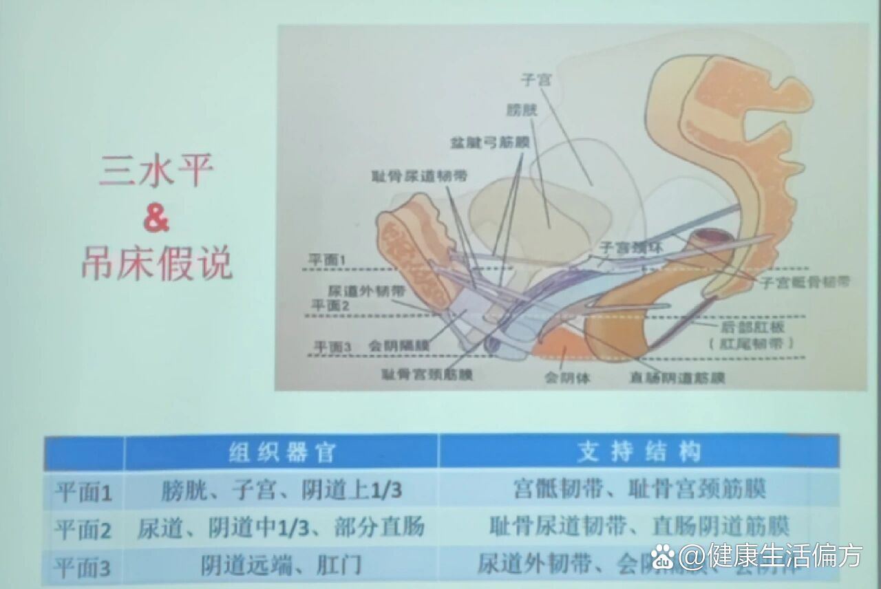 怎么知道自己阴壁膨出图片