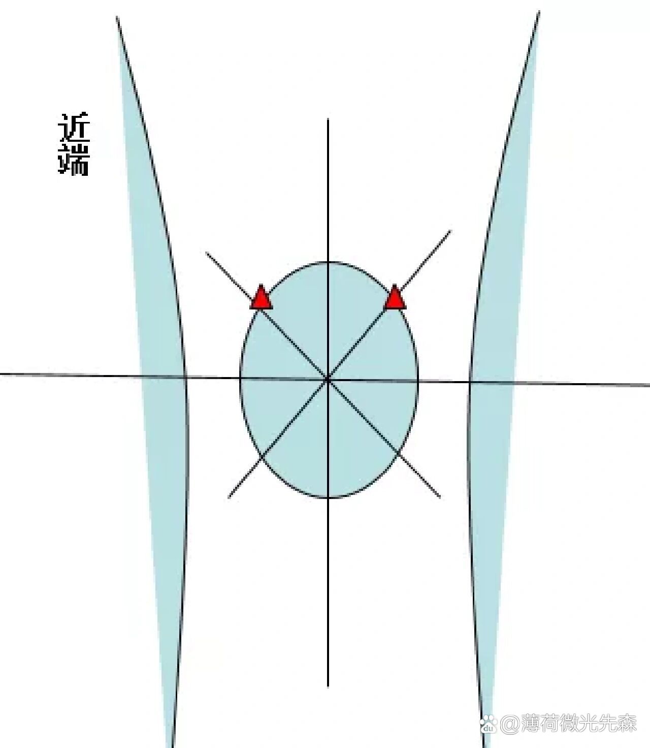 膝关节穿刺术图片