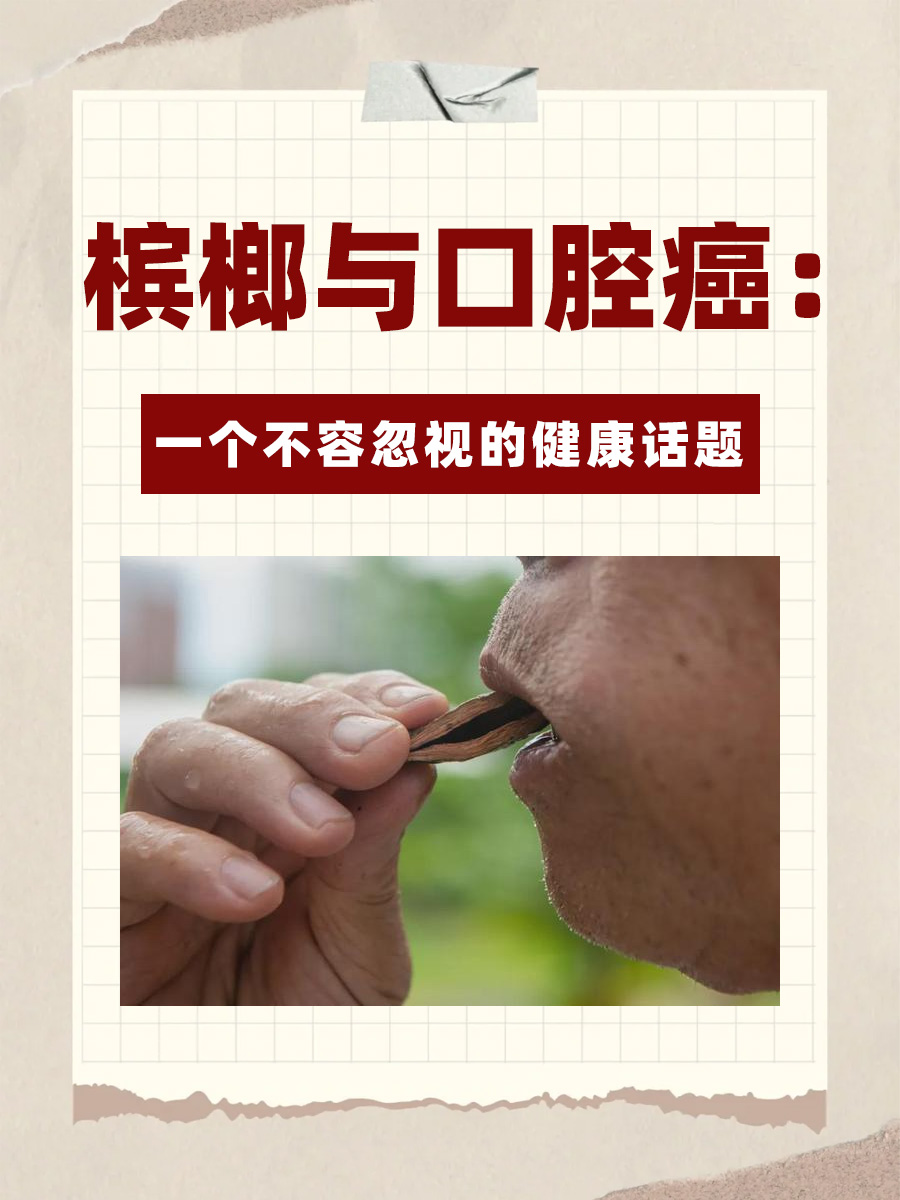 槟榔为什么会上瘾呢为什么在线 槟榔为什么会上瘾呢为什么在线