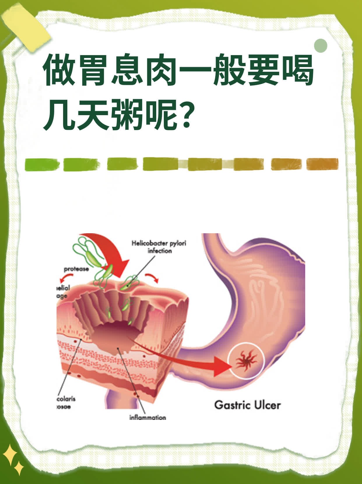 做胃息肉一般要喝几天粥呢