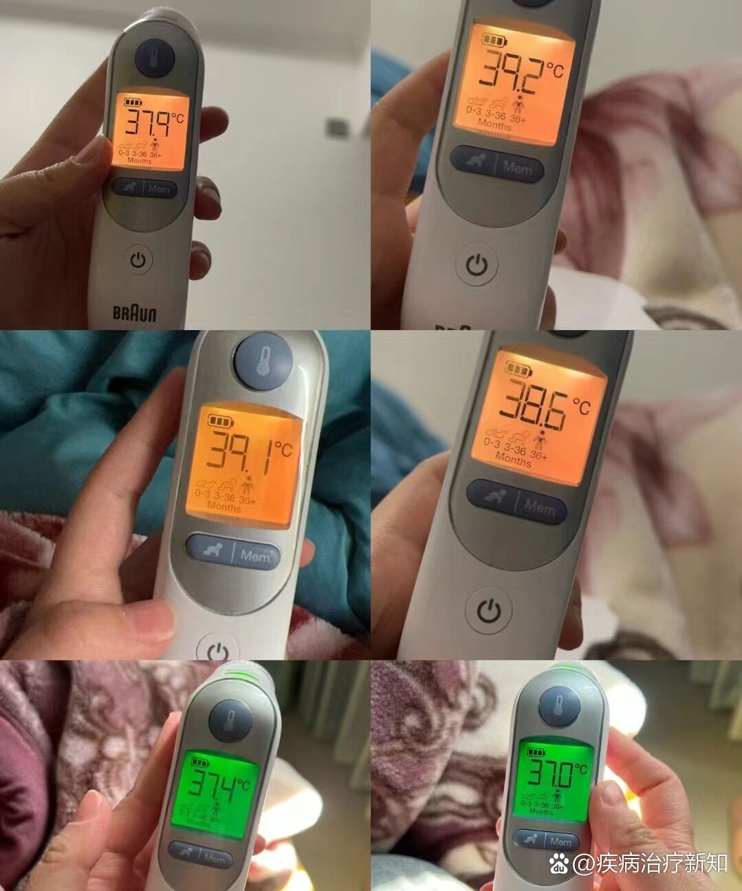 36.7摄氏度算发烧吗？