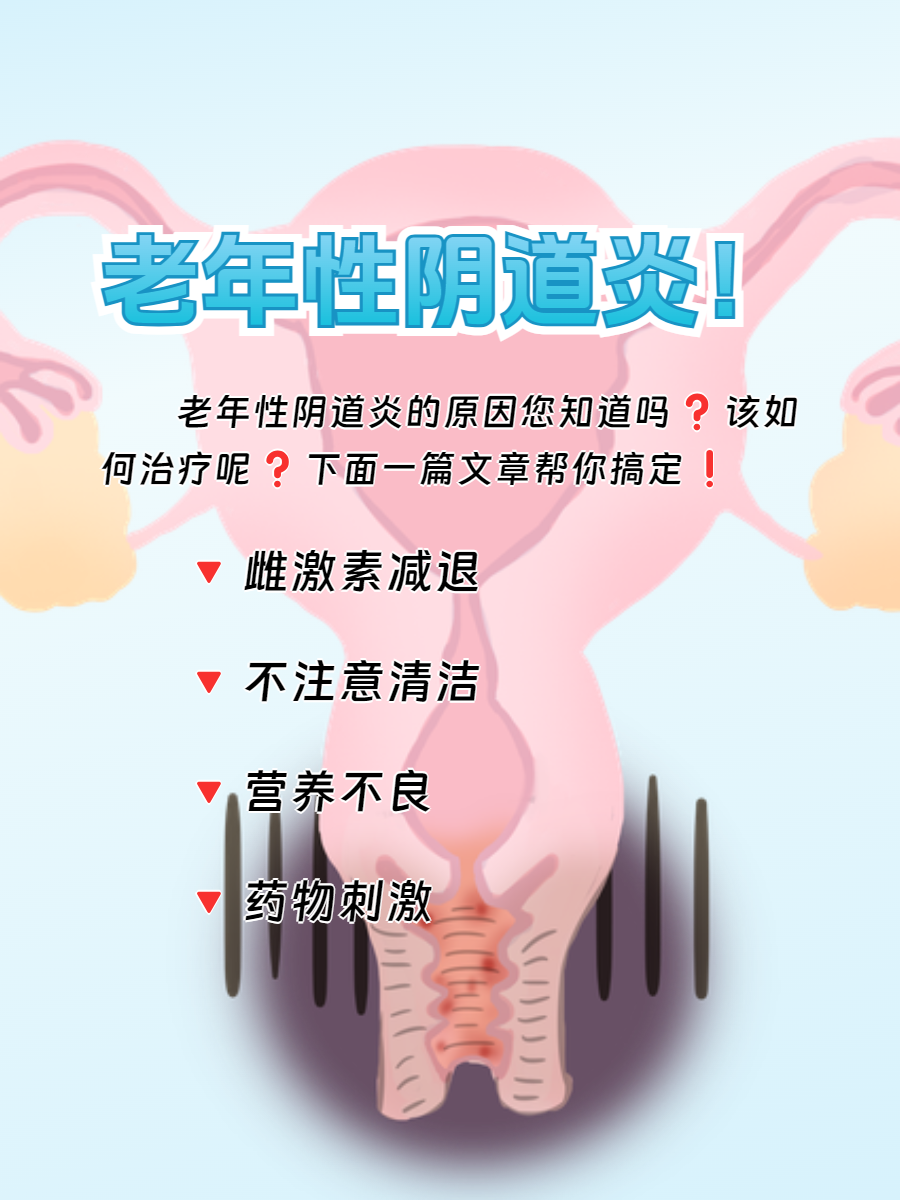 老年性阴道炎,你需要这样处理!