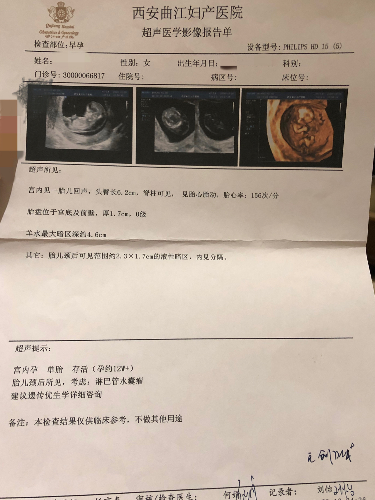 12周nt孕检没过