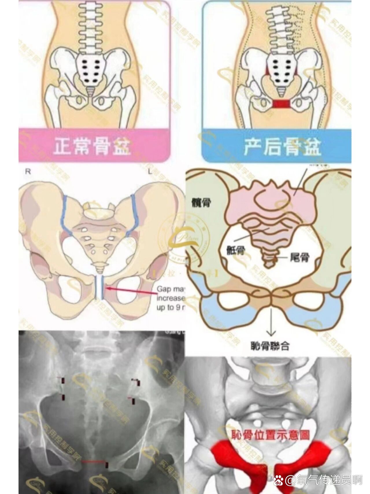 小知识分享之耻骨联合分离