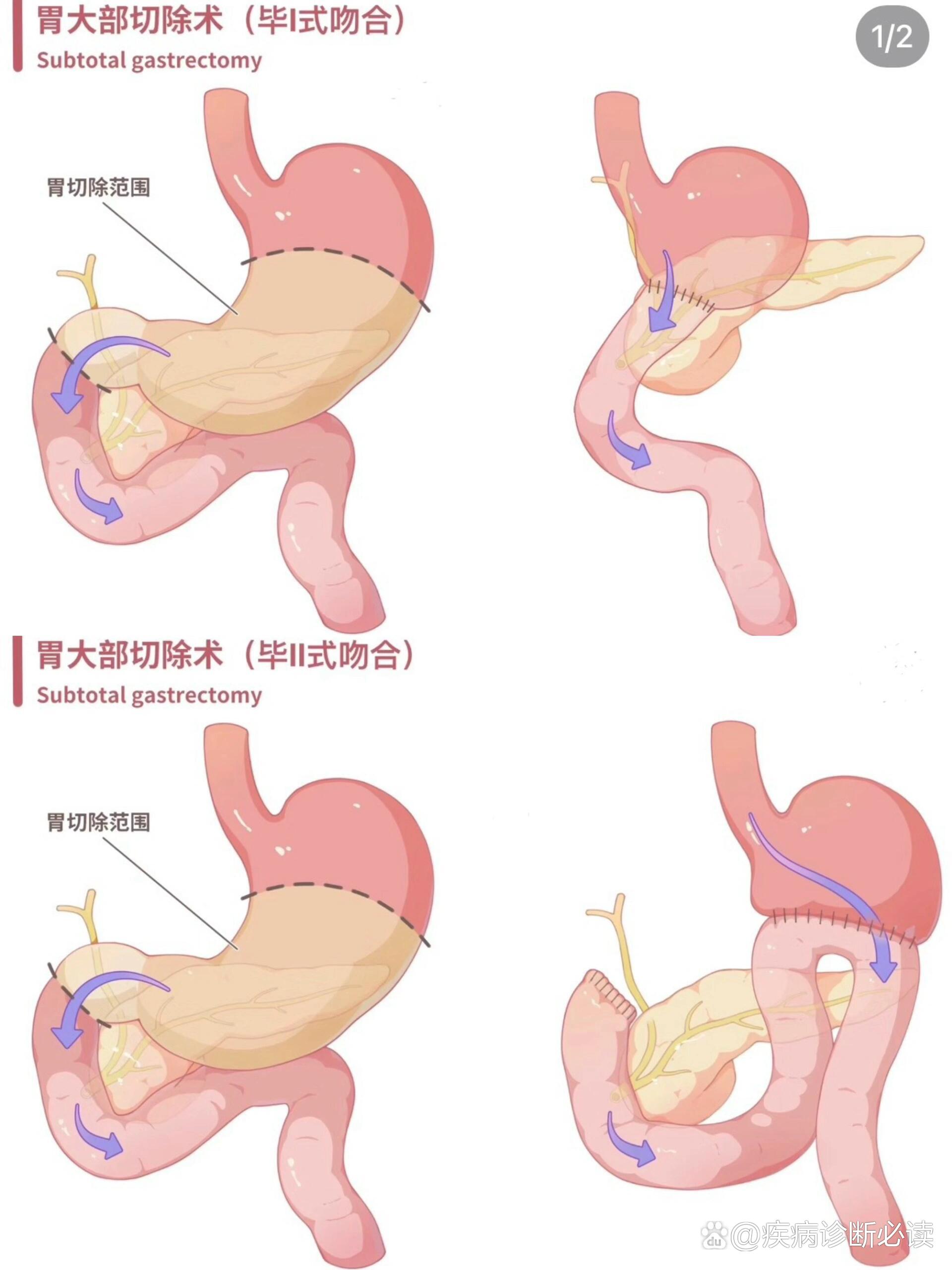 标志物cea/ca19