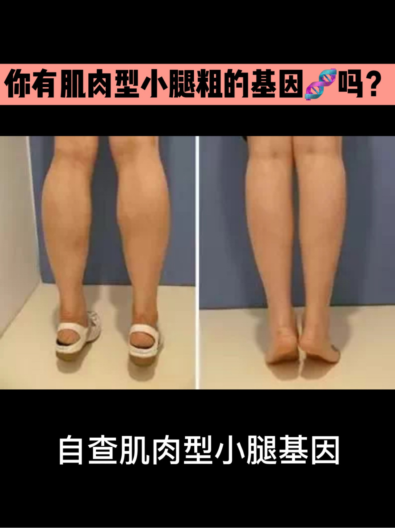 小腿肚低跟腱短图片