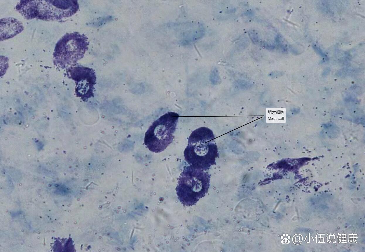 肥大细胞光镜图图片