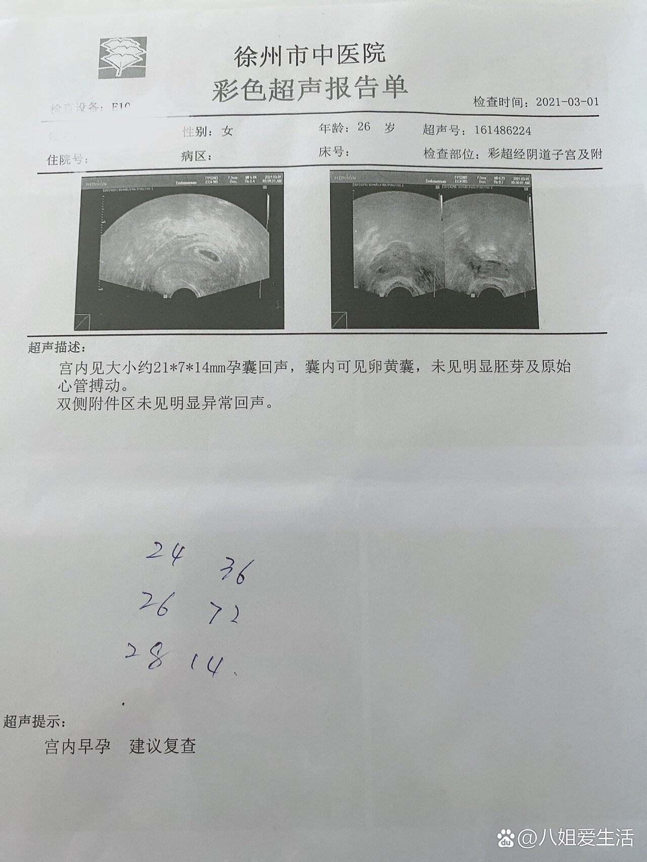 35天孕囊大小图片图片