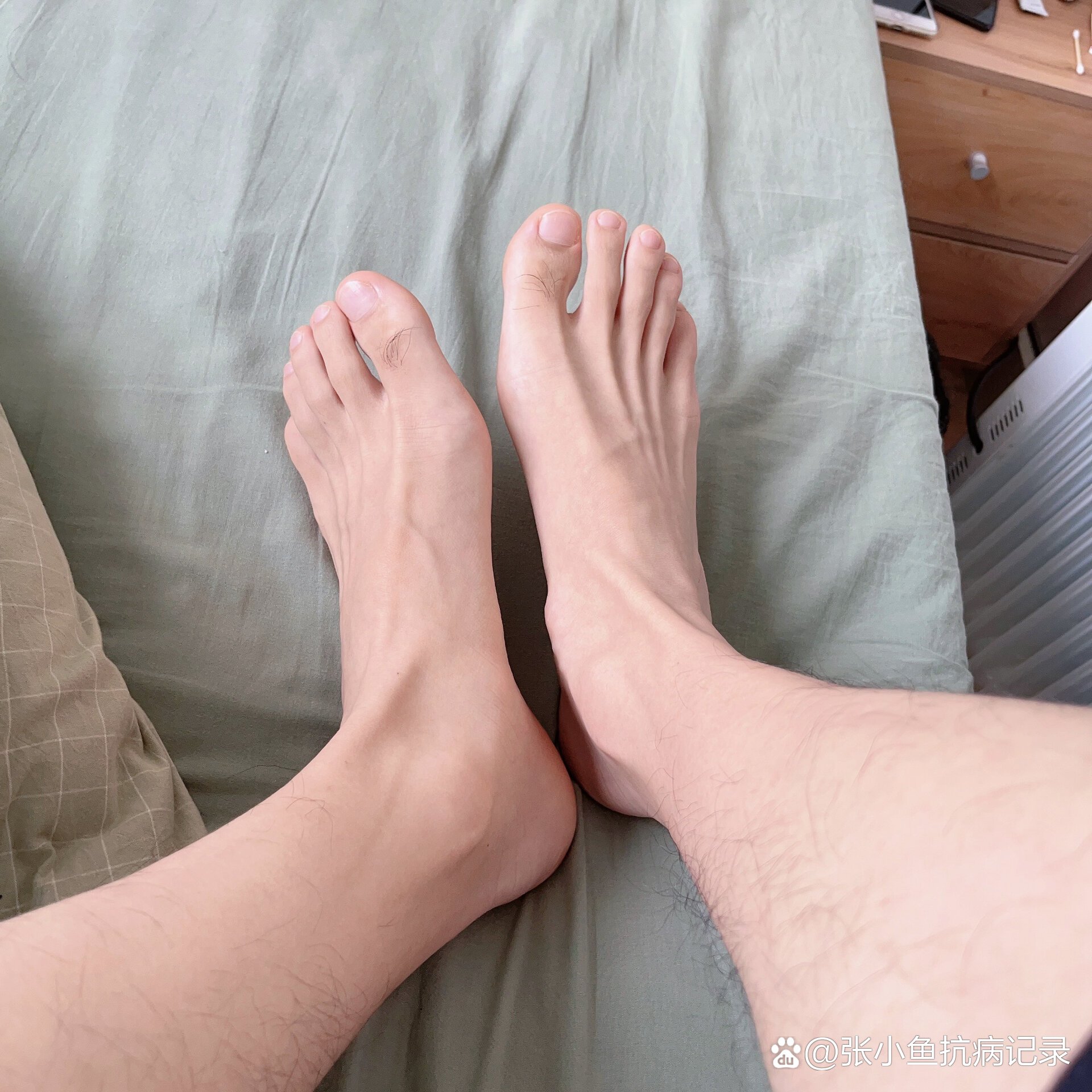 脚趾头上的毛毛越拔越长