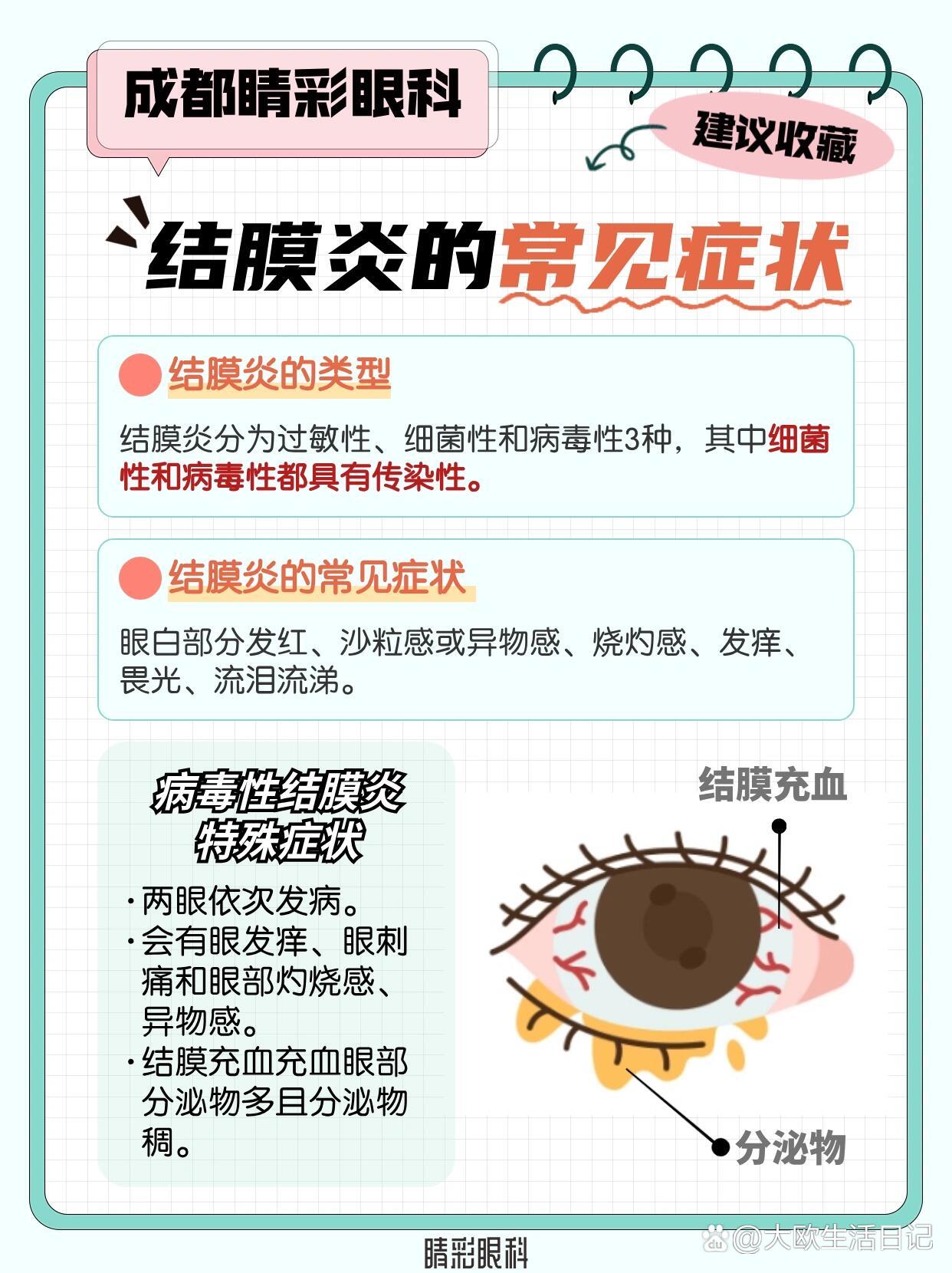结膜炎真的会传染吗71一文读懂结膜炎7515