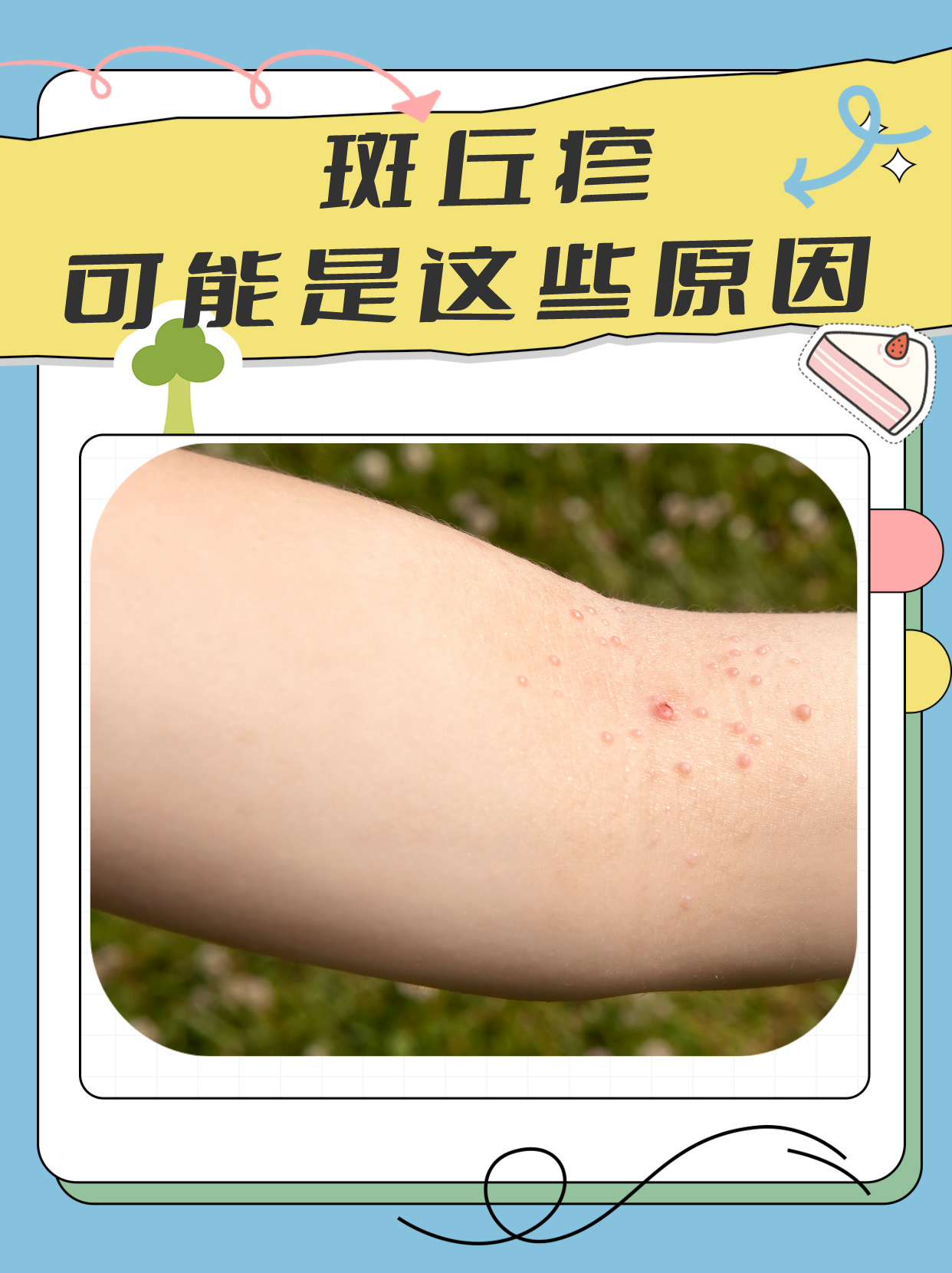斑丘疹?可能是这些原因