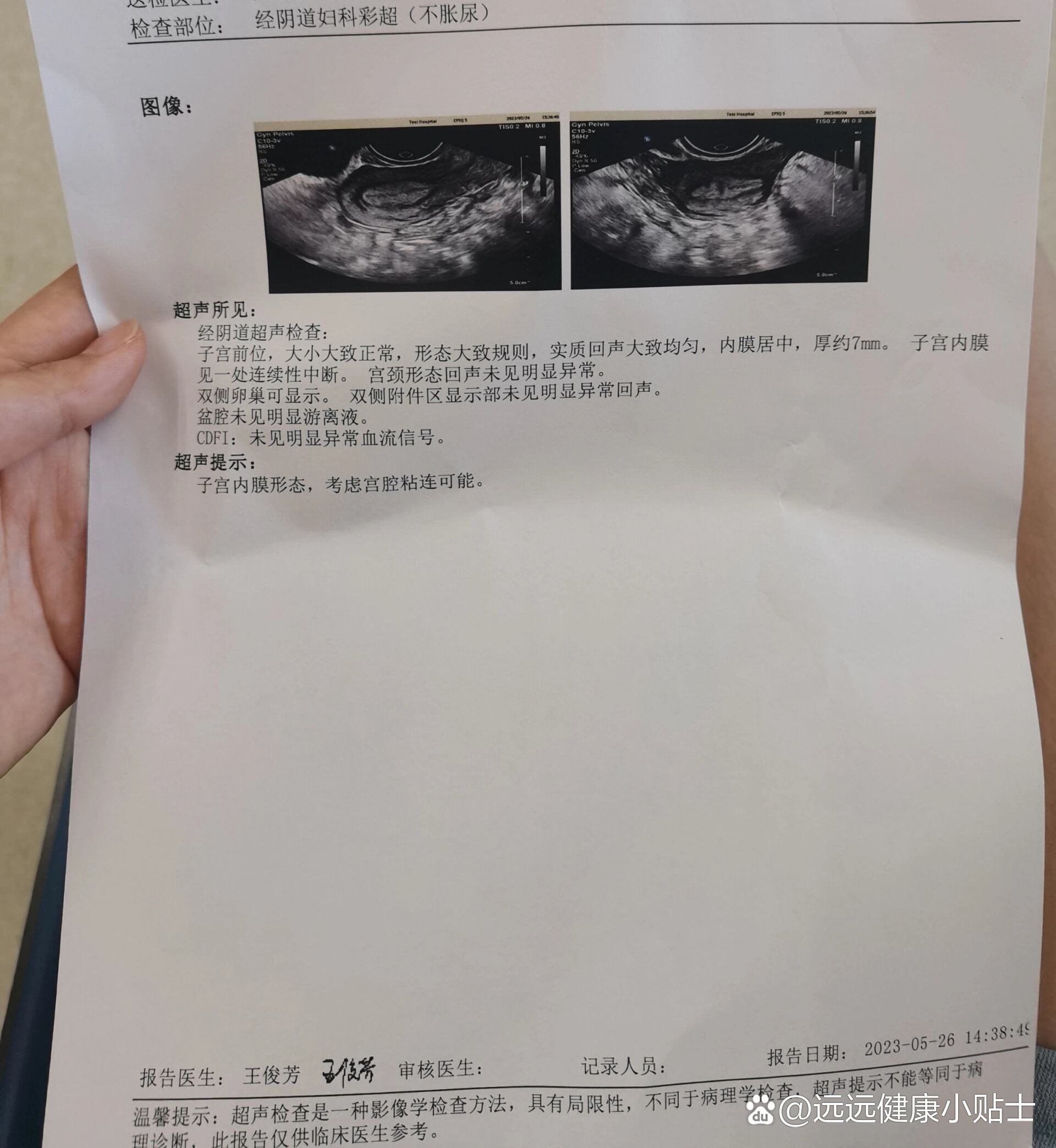 宫腔粘连没打算怀孕,要做手术吗