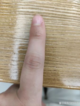 有人能解释为什么食指都是歪的呢