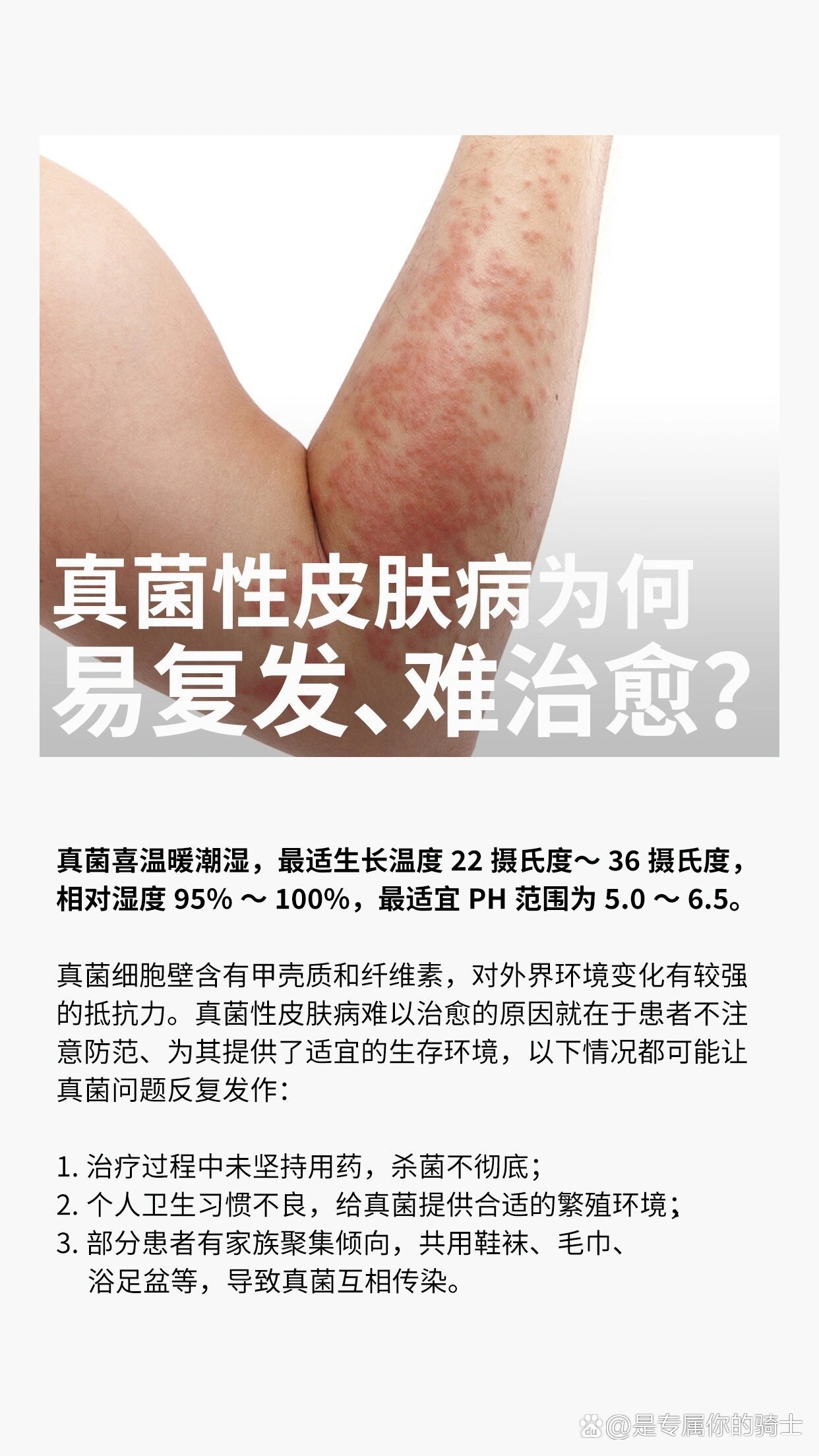 为什么会感染真菌孢子为什么在线 为什么会感染真菌孢子为什么在线