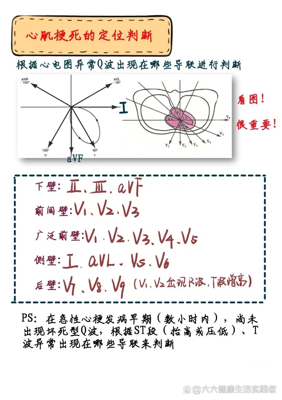 心梗位置判断 图图片