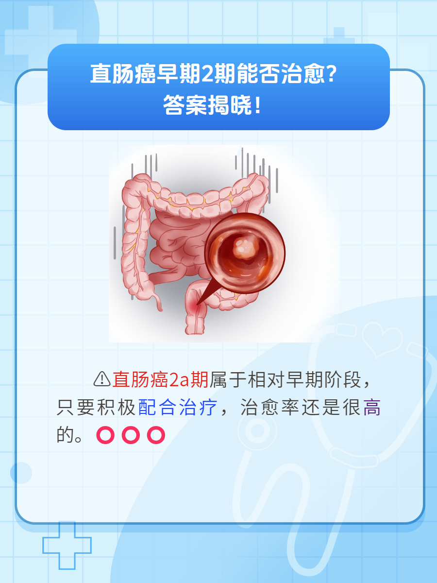 直肠癌一二三四期图片图片