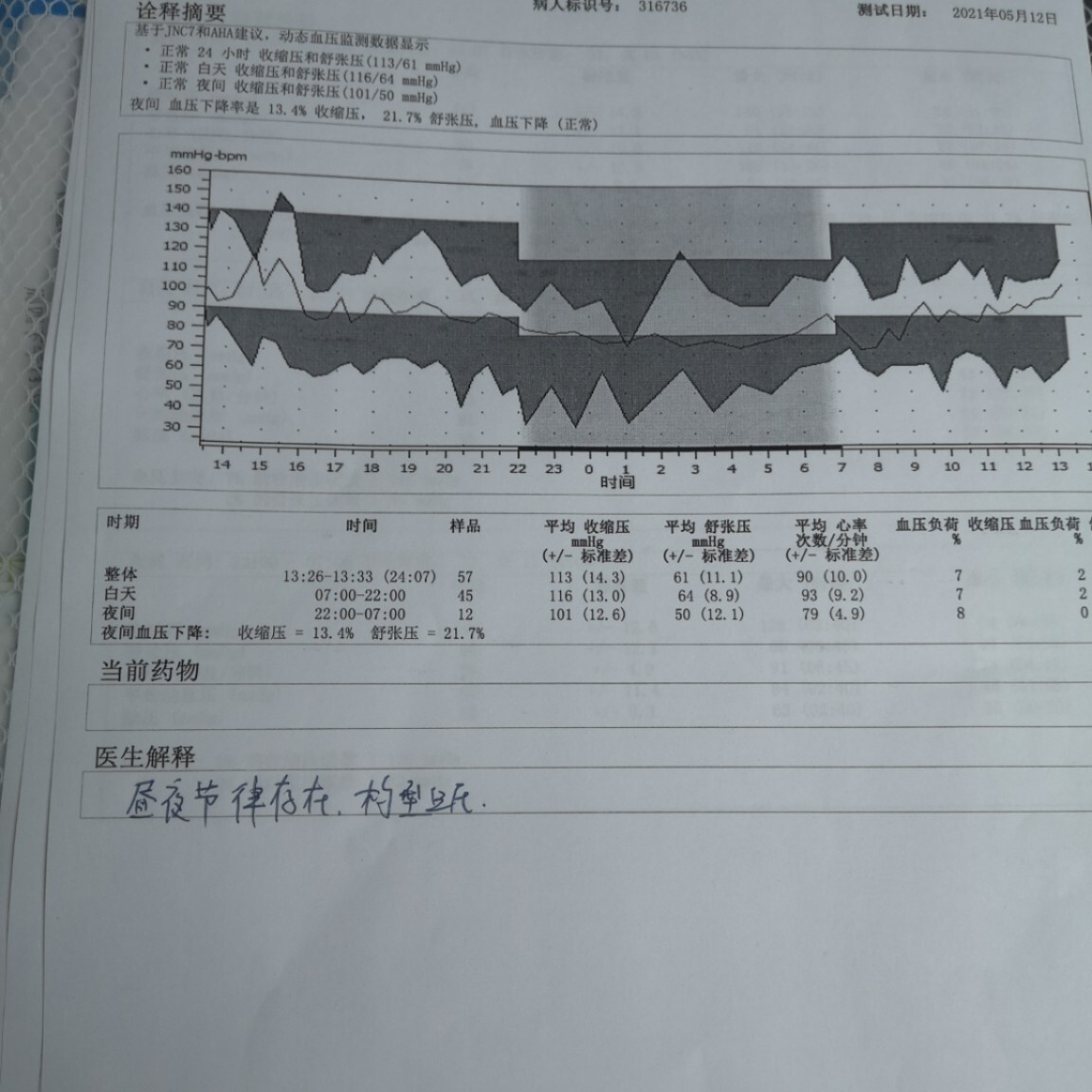 血压曲线图制作图片