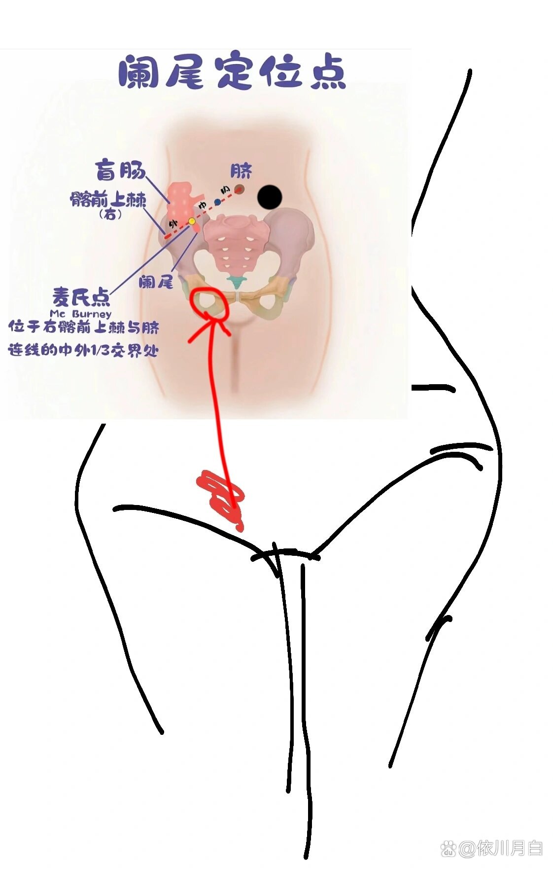 大腿根位置在哪里图片图片