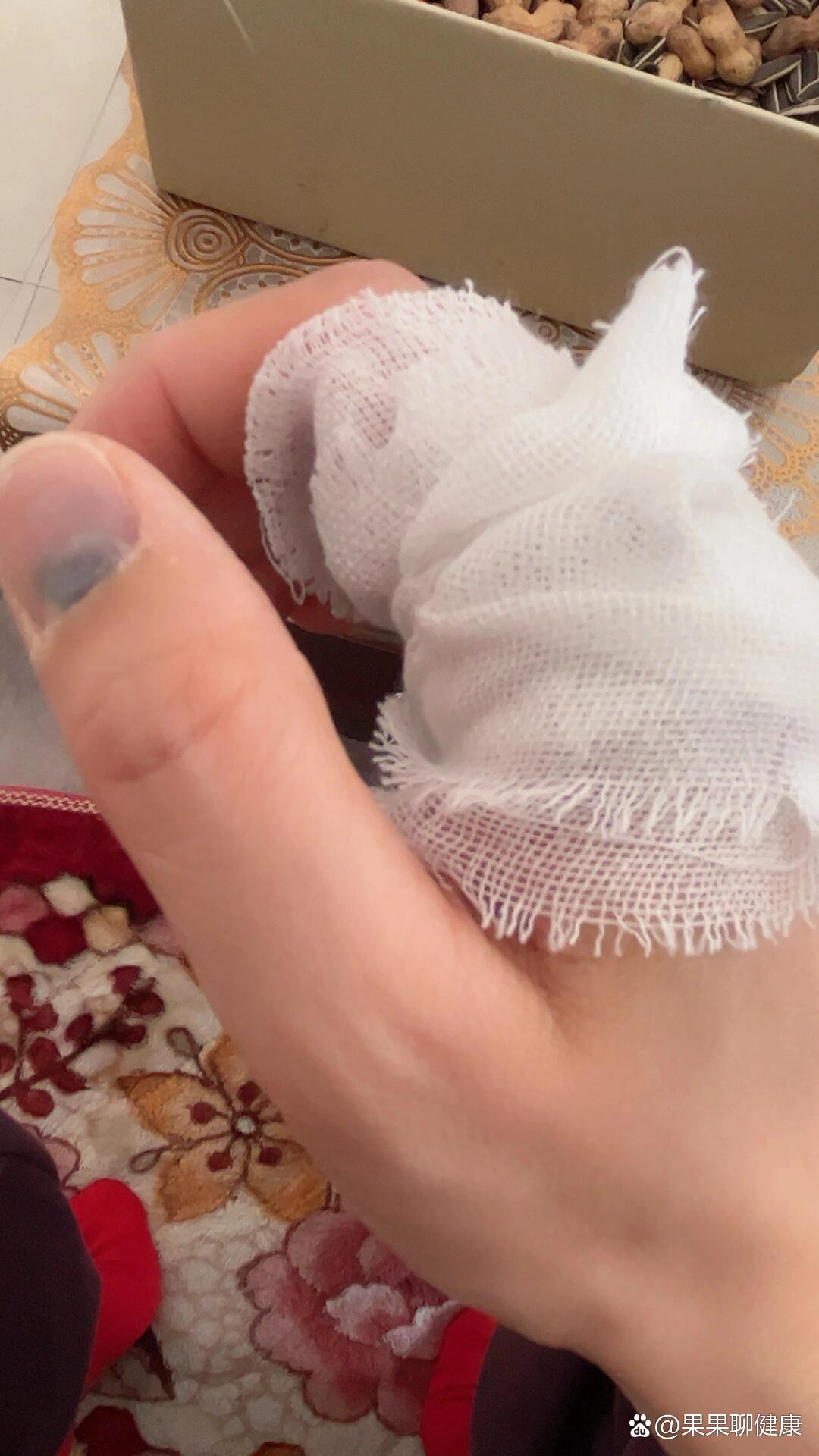 今天初一晚上洗碗突然碗整整齐齐的一半裂开右手小手指划破出血00 