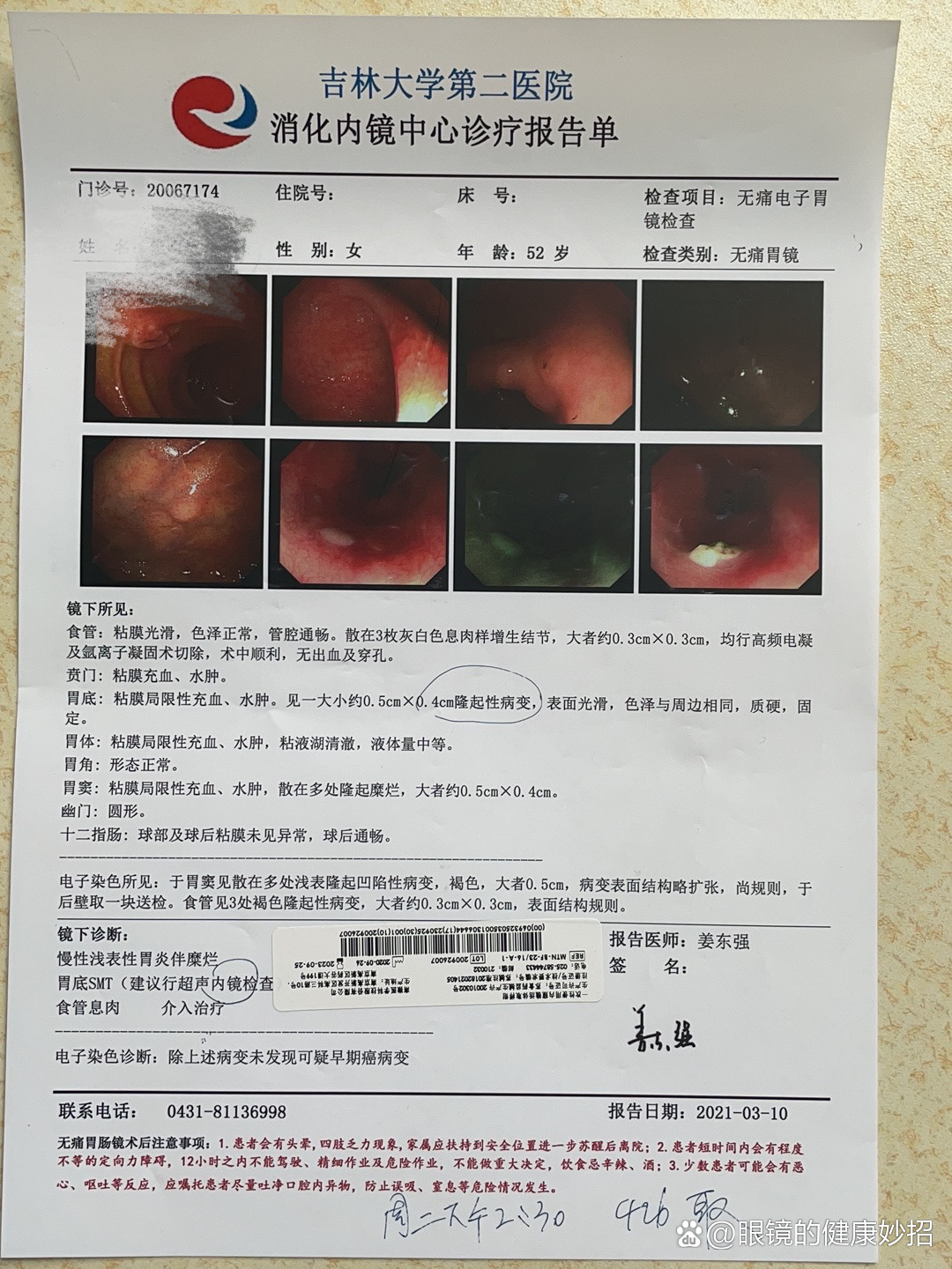 良性间质瘤图片图片