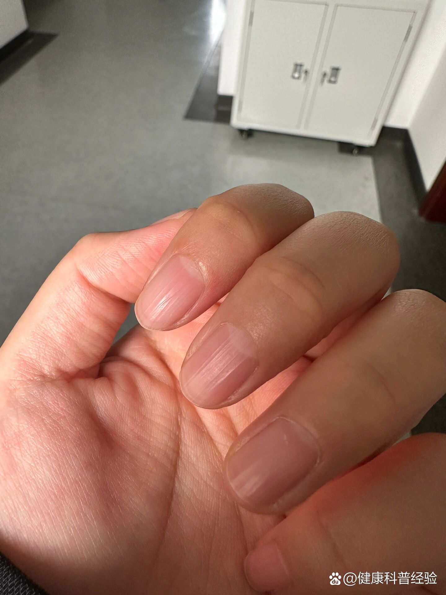 指甲上一条条的棱是什么回事呀