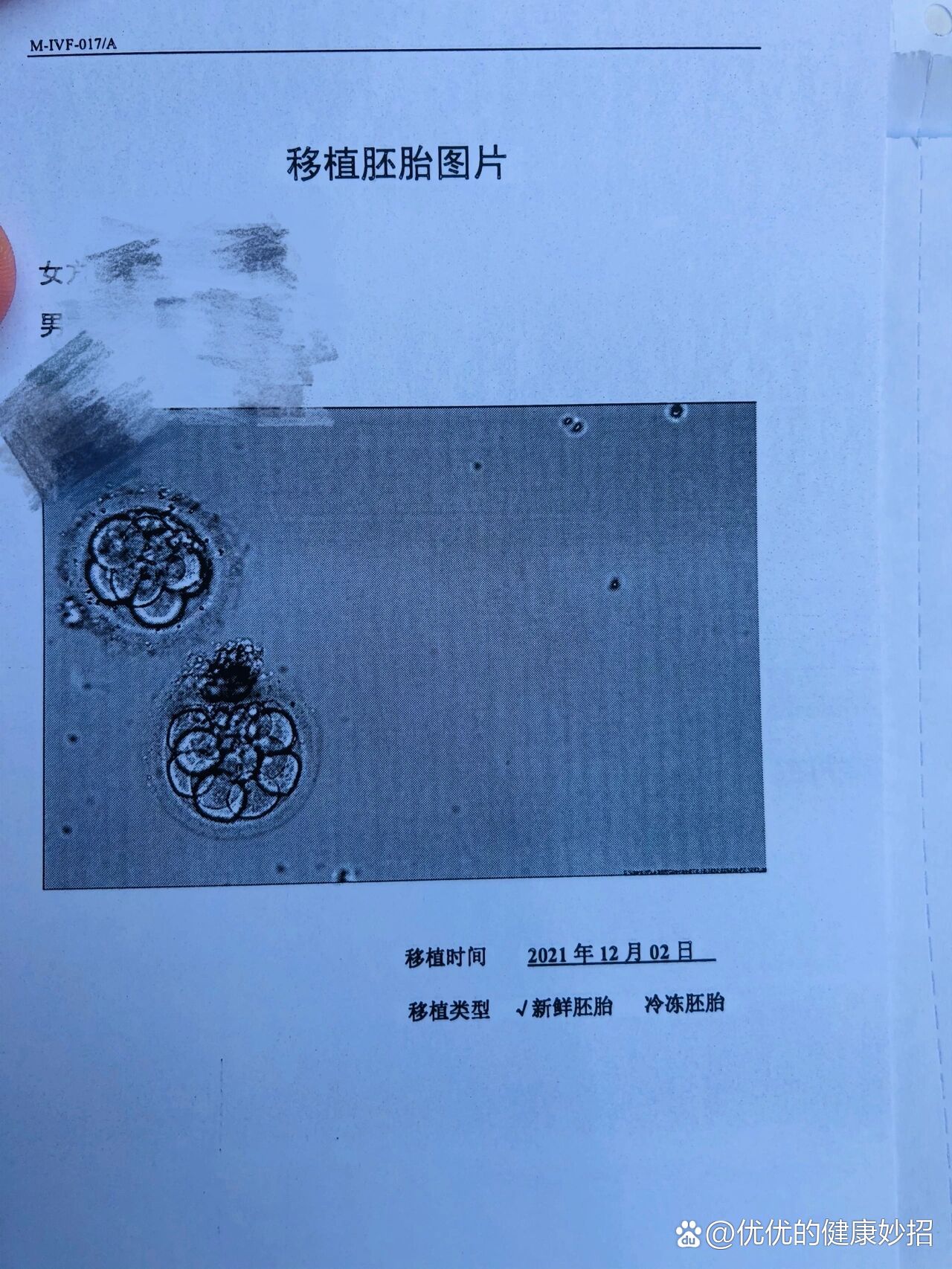 鲜胚移植第六天