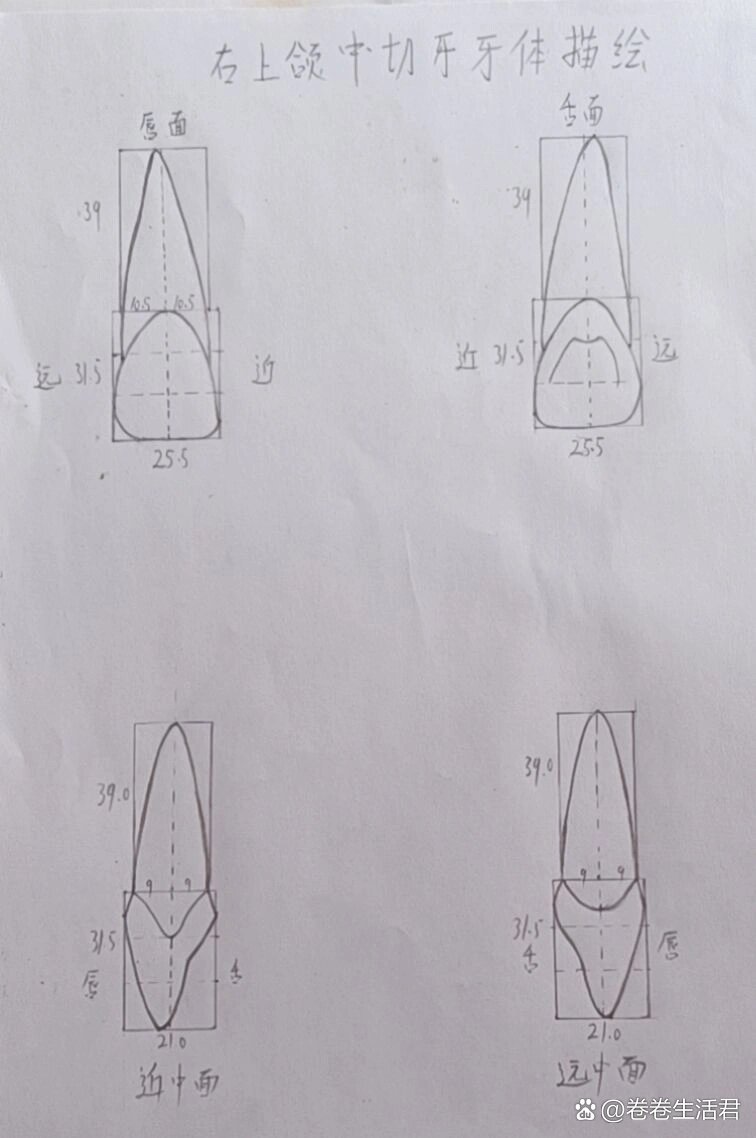 上颌中切牙画图步骤图片