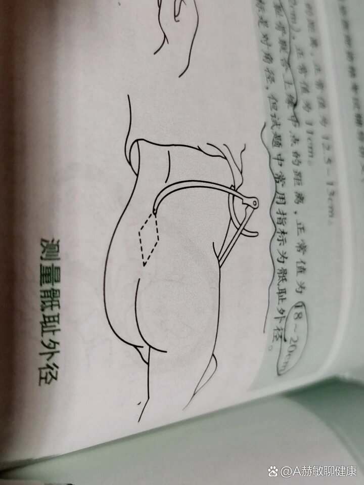 原来这个位置叫第五腰椎棘突下米氏菱形窝