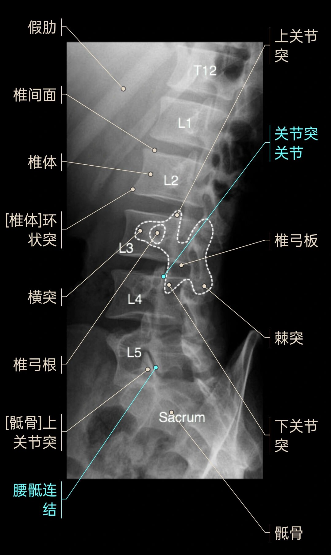 腰椎斜位x线摆位方法图片