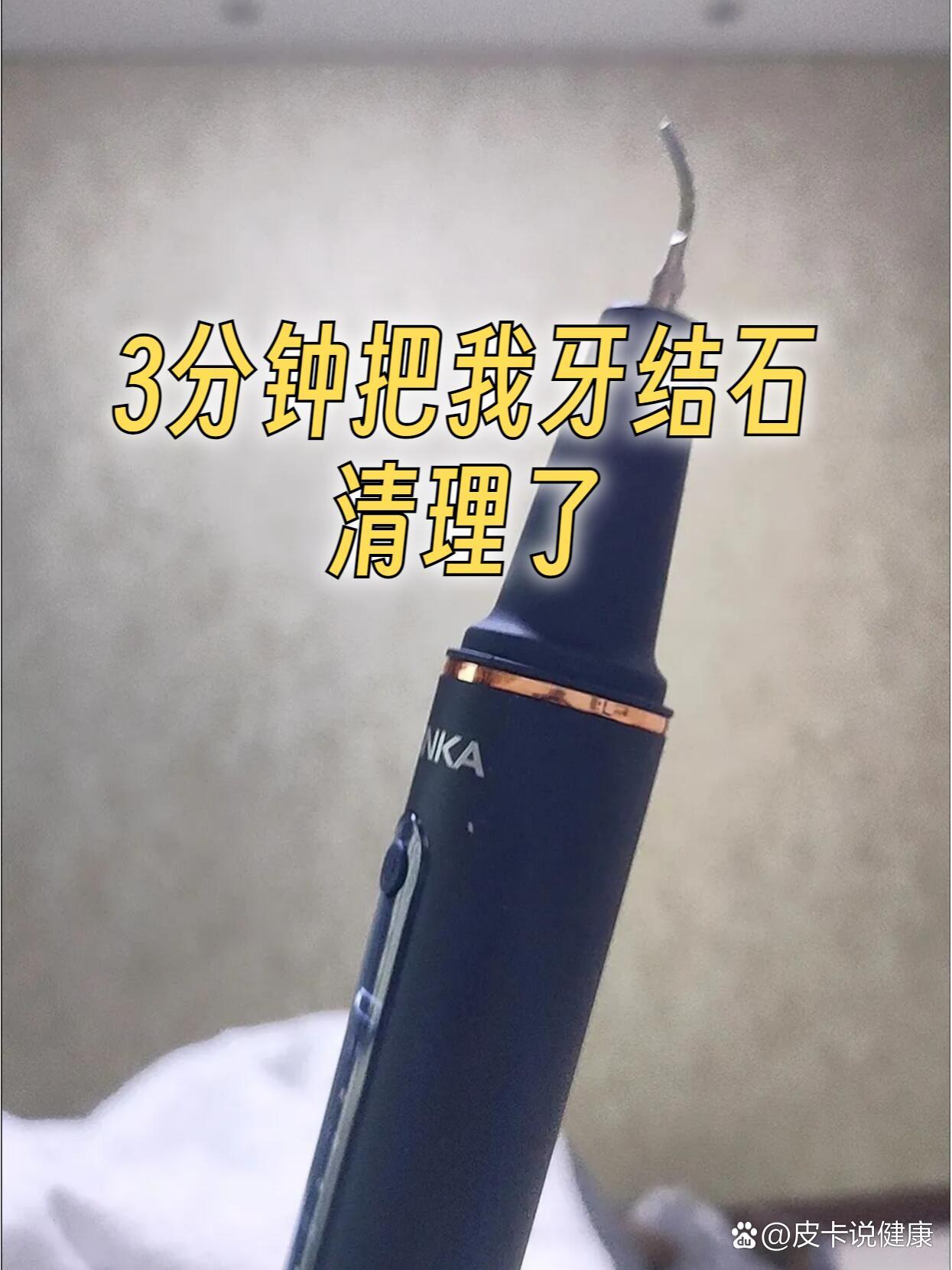 3分钟把我牙结石清理掉了