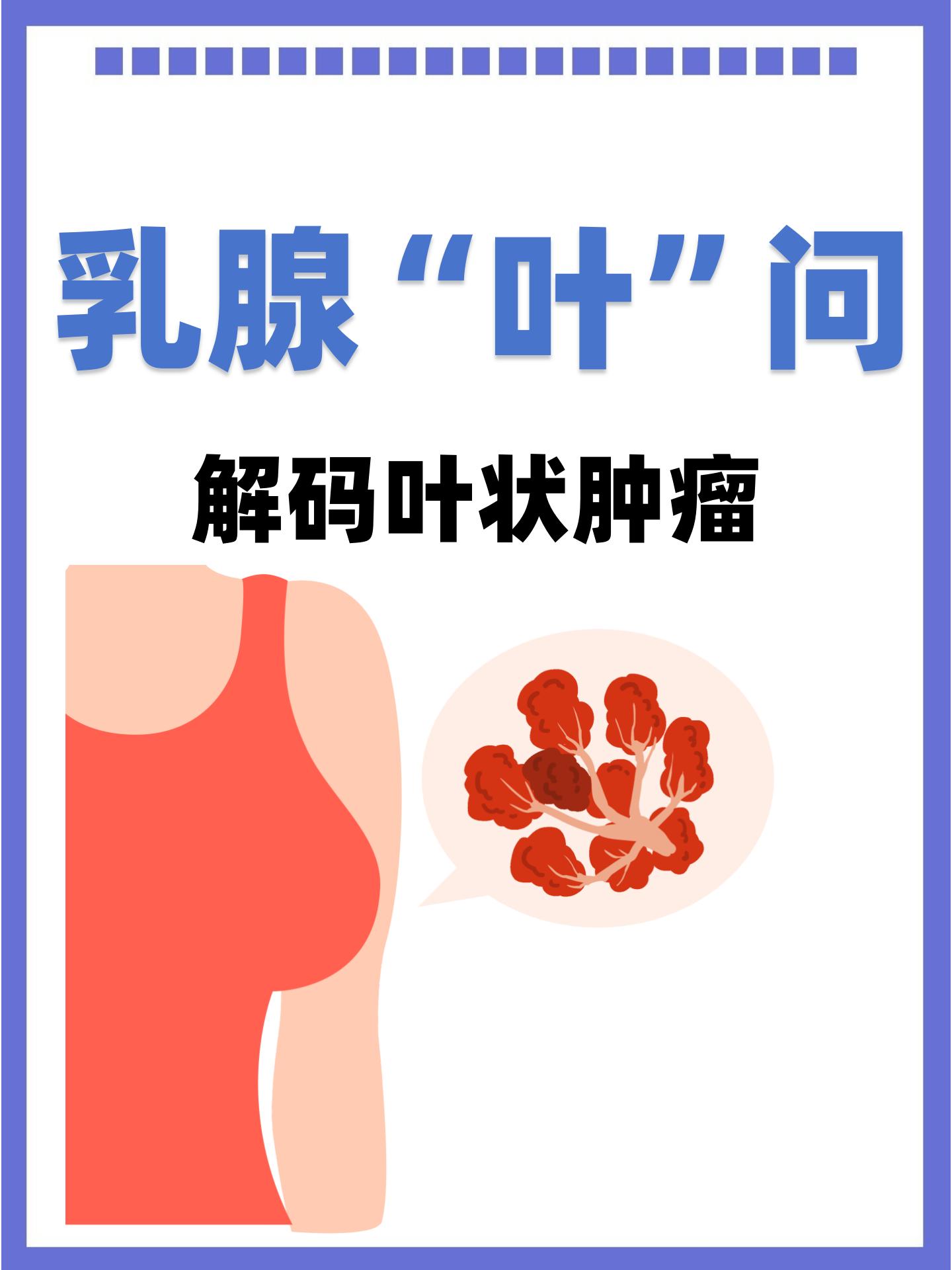 乳腺叶状肿瘤图片