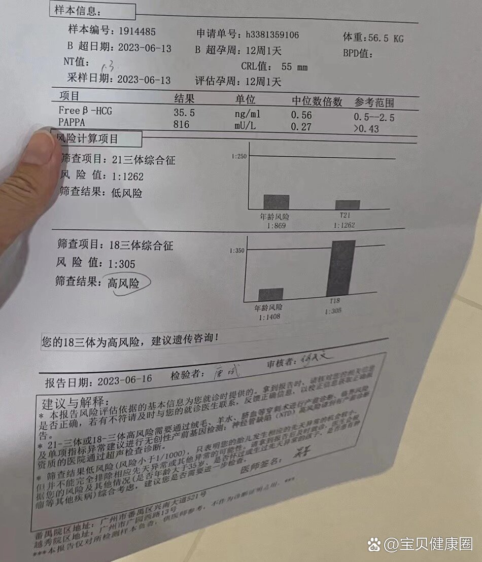 18三体综合症是什么图片