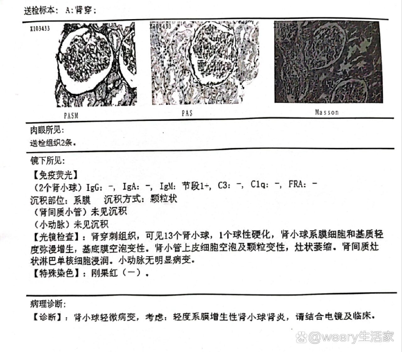 肾穿免疫荧光图片