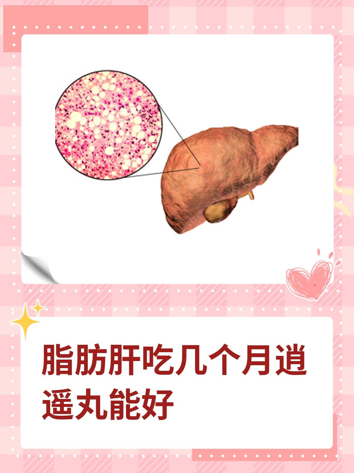 p>"我最近体检发现有轻度脂肪肝😔,想请问有什么好的治疗方法吗?