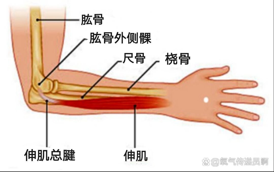 桡骨小头骨折位置图片