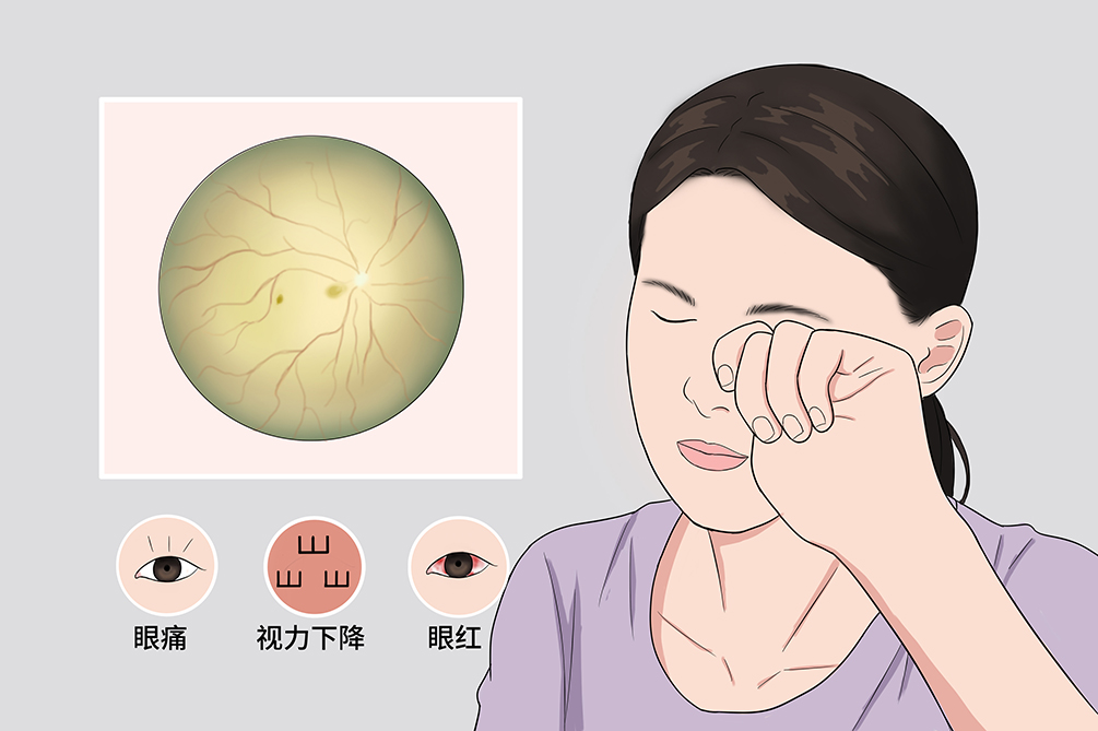 眼睛偶尔有闪光感